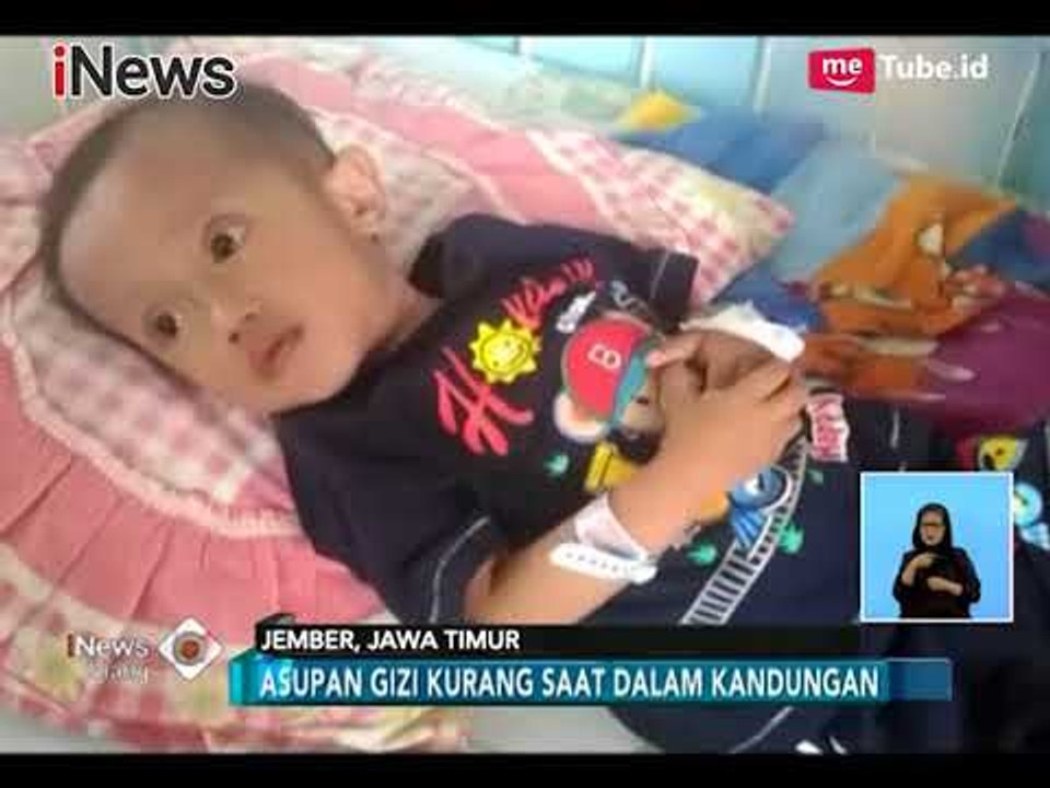 Indonesia Darurat Gizi Buruk Karena Orang Tua Kurang Pengetahuan - iNews Siang 02/02