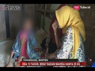 Bocah 13 Tahun Menderita Gizi buruk & Tuna Wicara Dapat Penanganan Khusus - Special Report 02/02