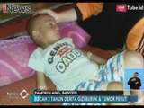 Miris!! Balita di Banten Alami Gizi Buruk & Tumor Namun Tak Masuk Asuransi BPJS - iNews Siang 04/02