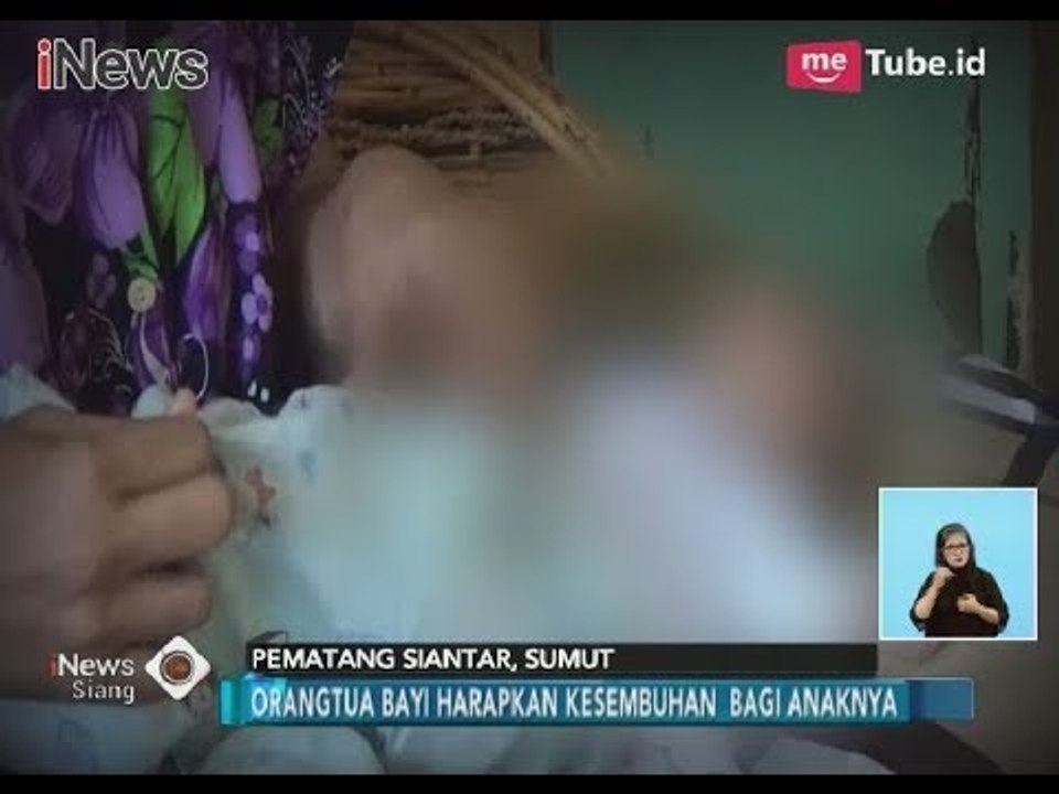 Orang Tua Bayi yang Alami Bocor Jantung Terus Berjuang untuk Kesembuhan Anaknya - iNews Siang 08/02