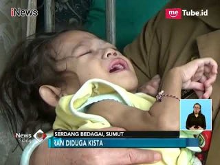 Nazwa Amalia, Bayi Malnutrisi di Serdang Begadai yang Kondisinya Memprihatinkan - iNews Siang 14/03