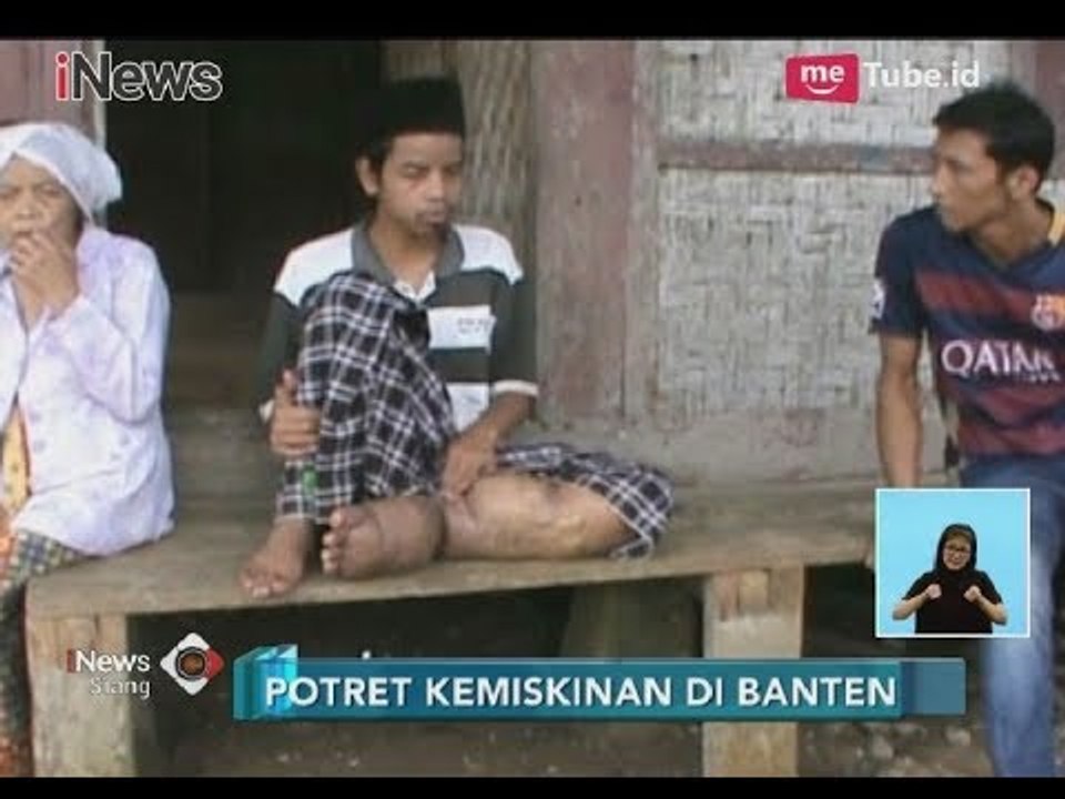 Prihatin!! Potret Kemiskinan, Derita Penyakit Kaki Gajah Selama 10 Tahun - iNews Siang 16/03