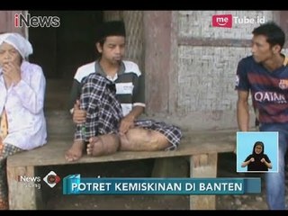 Prihatin!! Potret Kemiskinan, Derita Penyakit Kaki Gajah Selama 10 Tahun - iNews Siang 16/03