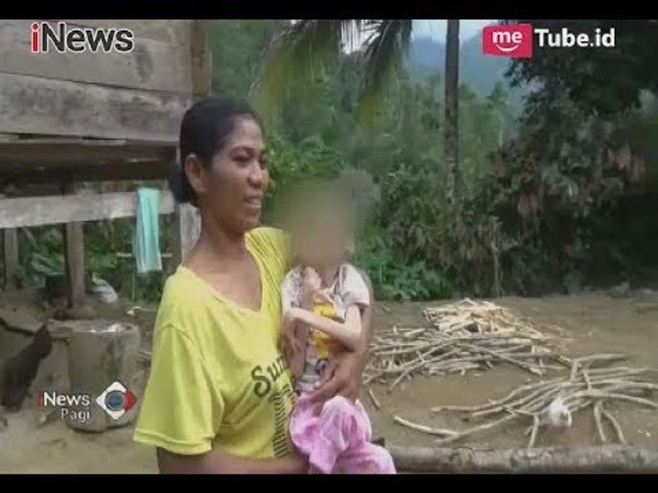 Miris!! Kisah Anak 15 Tahun Pengidap Gizi Buruk yang Hanya Terbaring Lemas - iNews Pagi 07/04