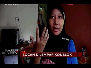 Bocah Dilempar Batu Jalani Operasi Plastik di Hidung & Pipi - Special Report 21/06