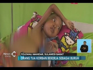 Memprihatinkan!! Bocah Berusia 9 Tahun di Polewali Mandar Mengalami Malnutrisi - iNews Siang 09/07