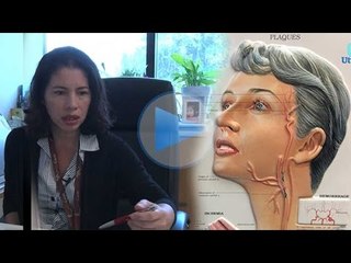 TIA tanda penting ancaman strok