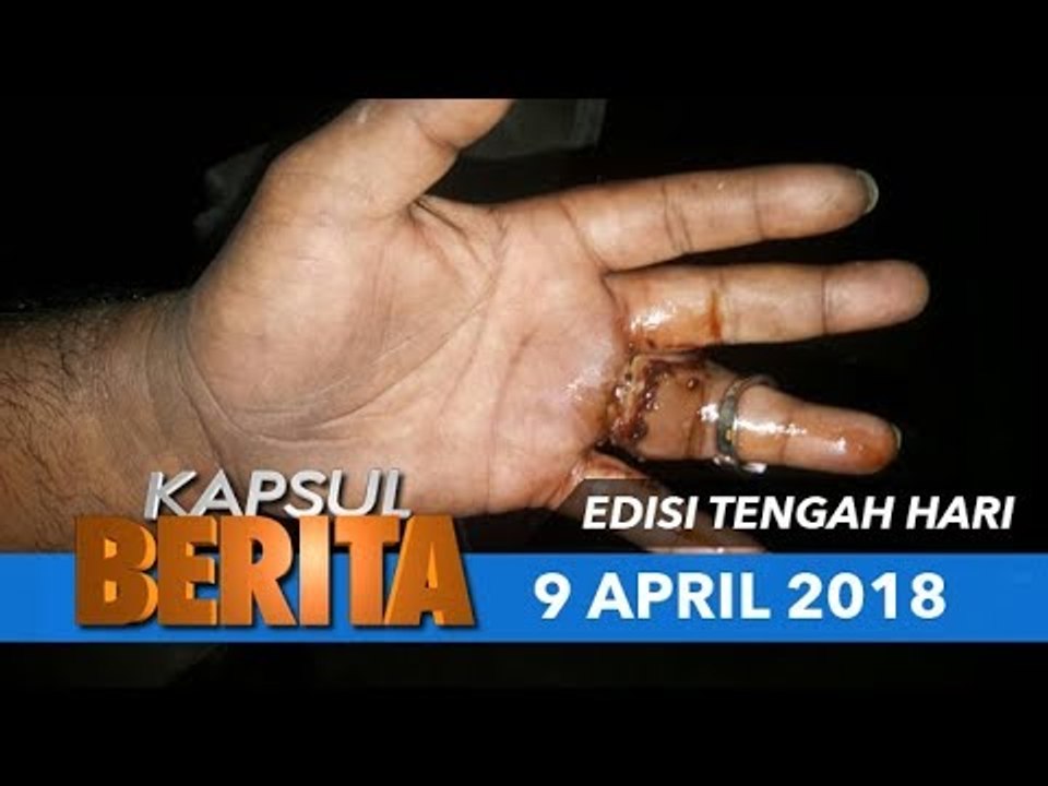 Cincin tersekat
