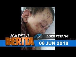 Bayi itu masih Trauma