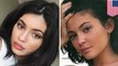 Kylie Jenner just had her lip fillers removed — here's how that's done