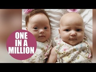 Meet the 'one in a million' twins - one with Down's syndrome and the other without