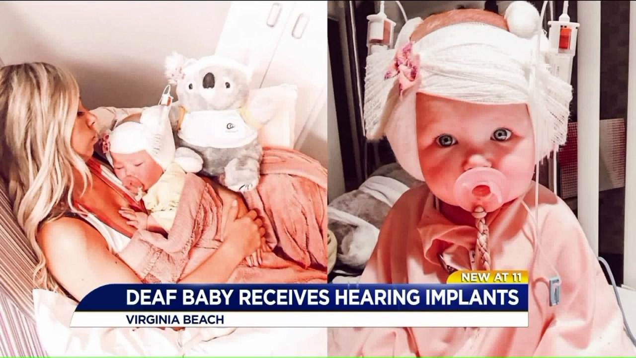 Baby Hears Mom's Voice for the First Time After Receiving Cochlear Implants