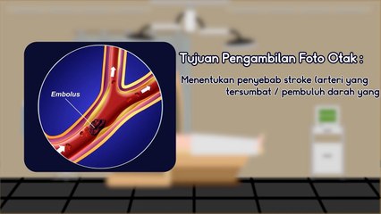 CHECK UP STROKE 5 DIAGNOSIS, PENGOBATAN STROKE