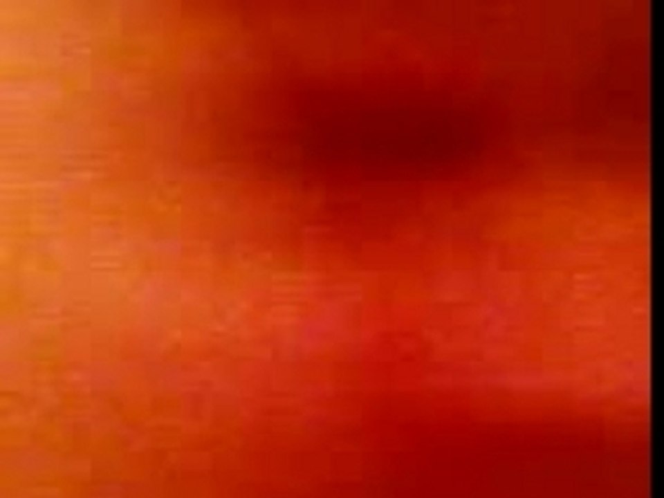 un érisson fou