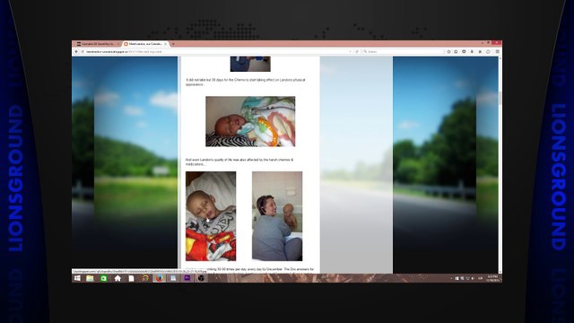 Cannabis Oil Cures Cancer Boy 3 Who Had 2 Days To Live!