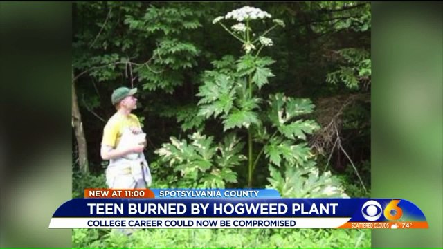 Teen Suffers Severe Burns From Giant Hogweed Plant