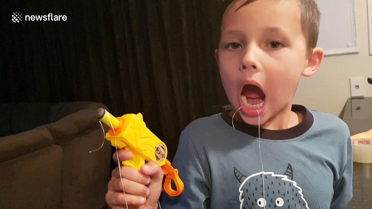 Look on boy’s face after removing tooth with Nerf gun is priceless
