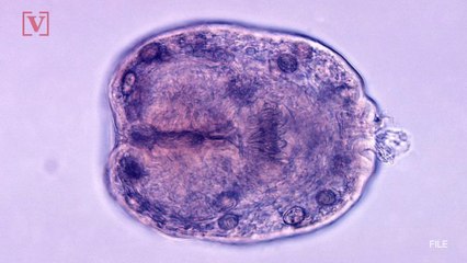 Tapeworm Found in Spine of Woman Complaining of Tingling, Trouble Walking