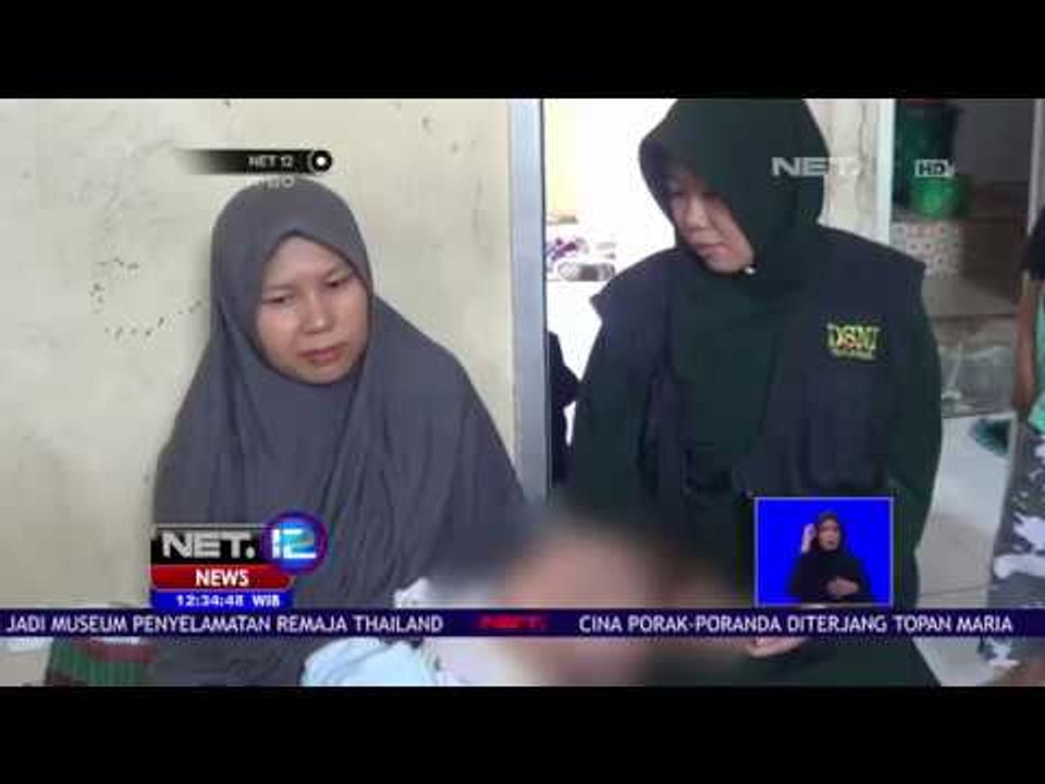 Bayi Berkepala Dua Dirawat Seadanya Di Rumah Kontrakan-NET 12