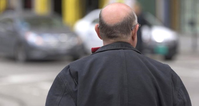 Yargıtay'dan Emsal Karar! Kocasına Kelloş Diyen Kadın Tazminattan Oldu