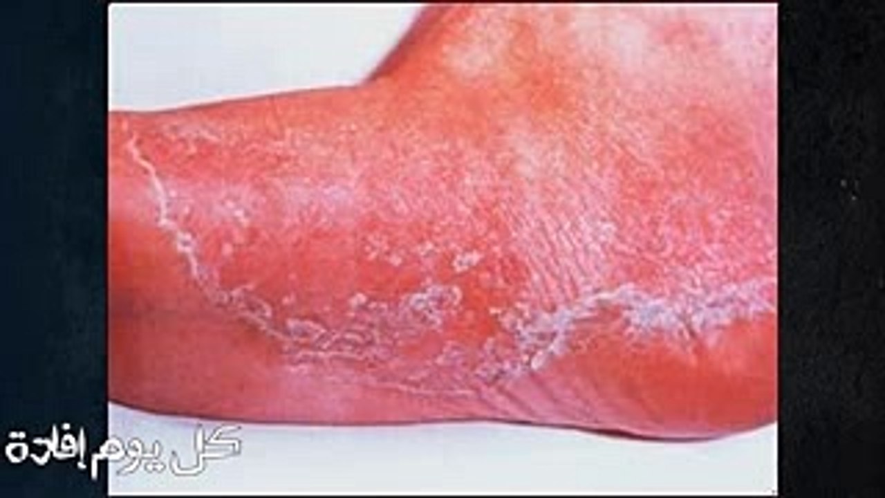 تناول الثوم على معدة فارغة وبعد 7 أيام هذا ما سوف يحدث لجسمك