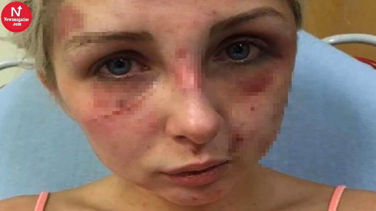 Teen Locks Girlfriend In Home And Beats Her For Hours, Then A Quick-Thinking Move Saves Her Life