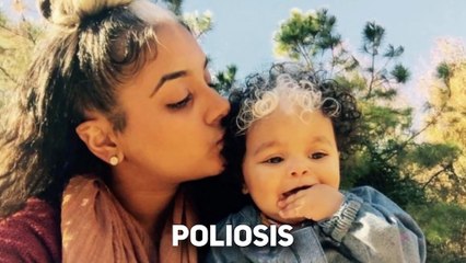 Top 10 Real Kids Born With Unbelievable Incredible Features