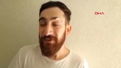 Mardin Hayat Tamircisi Bu Kez Bir Kartala Protez Ayak Yaptı