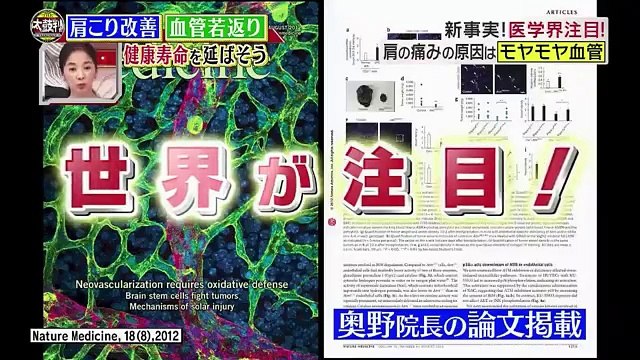 名医のＴＨＥ太鼓判！ＳＰ 180716 (2)