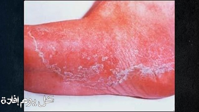 تناول الثوم على معدة فارغة وبعد 7 أيام هذا ما سوف يحدث لجسمك !