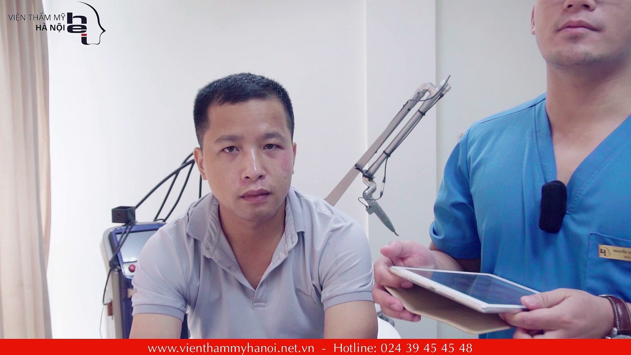 Xóa bỏ nỗi ám ảnh Sẹo thâm với công nghệ Spectra Laser