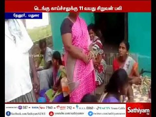 மதுரையில் டெங்கு காய்ச்சல் பாதிக்கப்பட்ட 11 வயது சிறுவன் பலி
