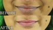 Dark lips: Homemade pack | DIY | काले होंठों को गुलाबी बनाता है ये आसान नुस्खा | Boldsky