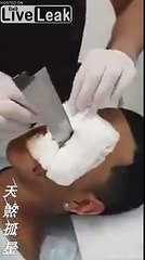 Retirer un couteau.. planté dans la joue !