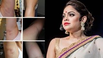 Sumona Chakravarti badly suffers wax SKIN BURN, SLAMS online service provider। FilmiBeat