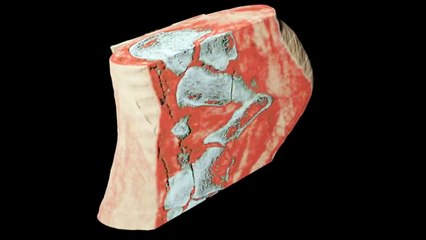 Color X-Ray Scan by MARS