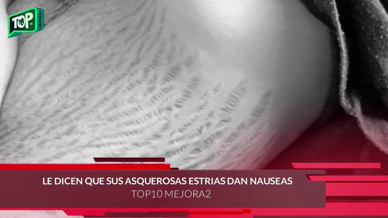 Le decían que sus “Horribles estrías dan náuseas” pero lo que hizo esta madre no lo hace cualquiera