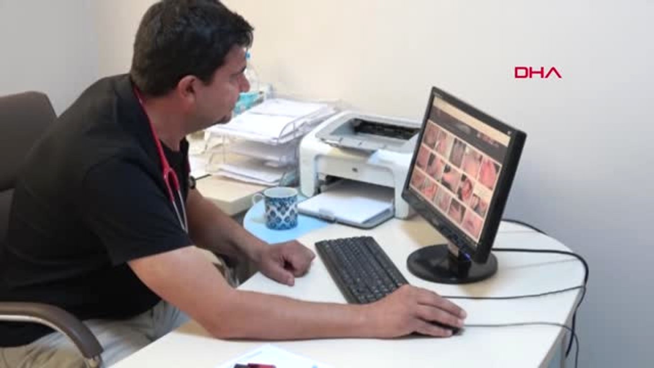 Adana Çocuklu Ailelere 'Kızarıklık' Uyarısı
