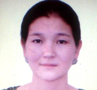 Go-Kart Kazası Geçiren Genç Kızın Kopan Deri Parçaları Kafatasına Dikildi