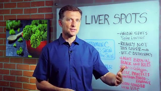 What Causes Liver Spots (Aging Spots)_ Hint...it's NOT the liver