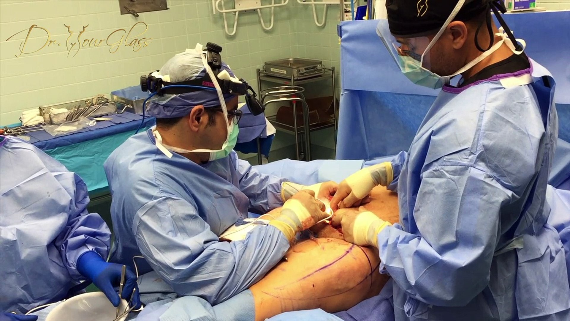Why hematomas occurs after plastic surgery ?