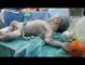 Kendi Canlarını Hiçe Sayarak Bombardıman Esnasında Bir Bebeği Hayata Tutunduran Doktorlar