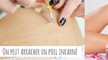 10 idées reçues sur l'épilation