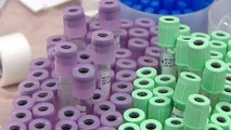 Noticia | Descubren el primer análisis de sangre capaz de detectar melanomas