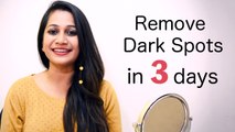How To Get Rid Of Dark Spots In 3 Days | Boldsky