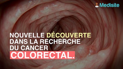 Cancer du côlon : un taux de survie réduit si il touche le côté droit
