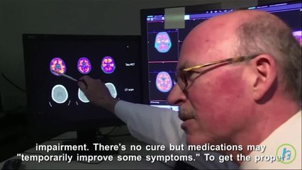Dementia Diagnosis And Brain Scans