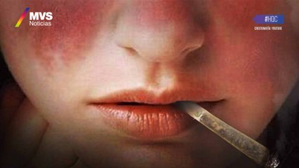 ¿Qué es la enfermedad de Lupus?