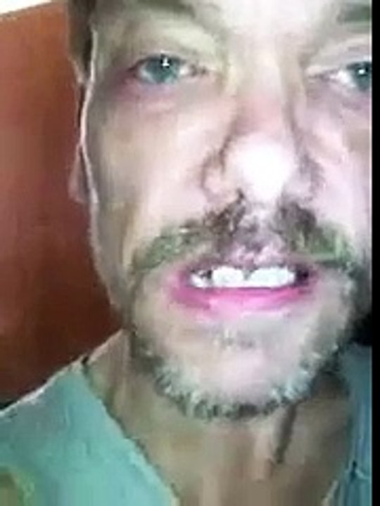 Kopfnuss Kalli Missgeburt mit Loch im Vene (360p_30fps_H264-96kbit_AAC)