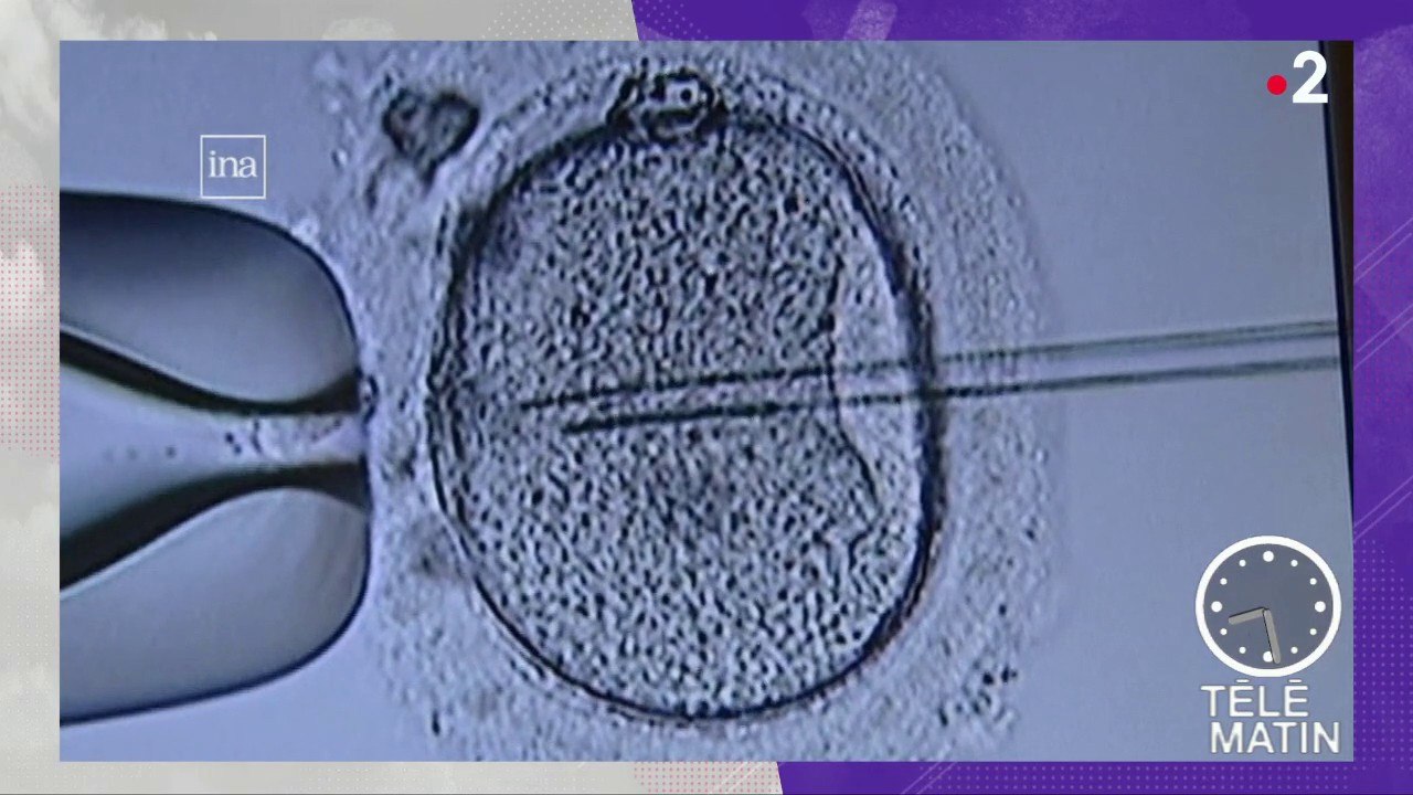 Actu plus - La fécondation in vitro
